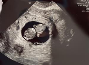 Baby Rosado